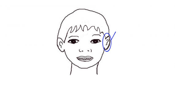 Tegning av et hode med fokus på øret.