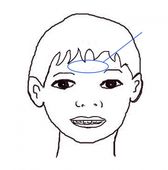 Tegning av et hode med fokus på pannen.