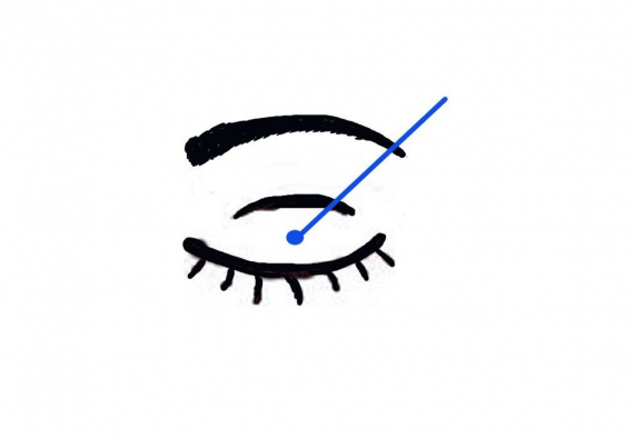 Tegning av en øyelokk.