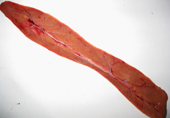 Fiskelever på et bord.