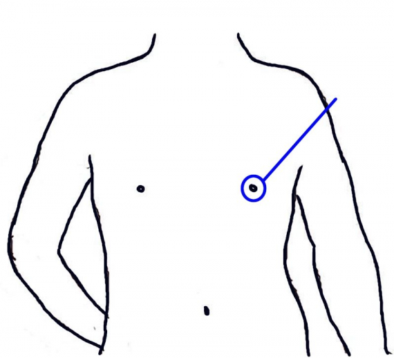 Tegning av overkroppen.