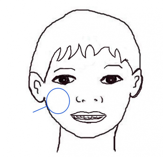 Tegning av et hode med fokus på kinnet.