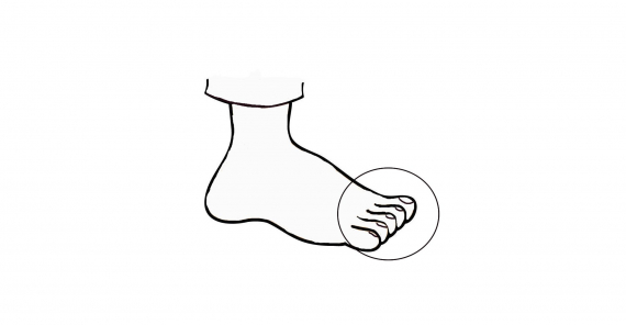 Tegning av en fot med fokus på tærne.